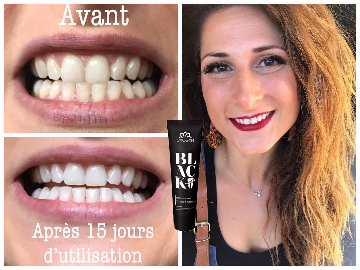 BLK01B-Dentifrice Black Power élimine les bactéries, éclaircit les taches dentaires au charbon actif